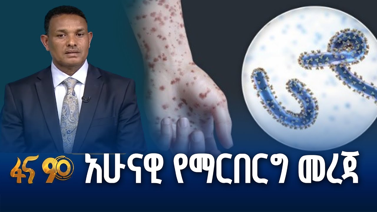 የማርበርግ ቫይረስ ወቅታዊ መረጃ