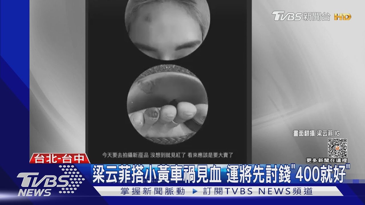 梁云菲搭小黃車禍見血! 運將先討錢「400就好」傻眼:我都受傷了