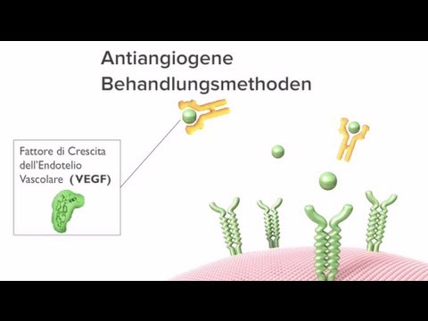 Antiangiogene Methoden zur Behandlung von feuchter AMD: ANIMATION