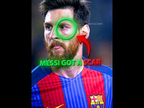Messi's Scar Changed Everything ❤️‍🩹