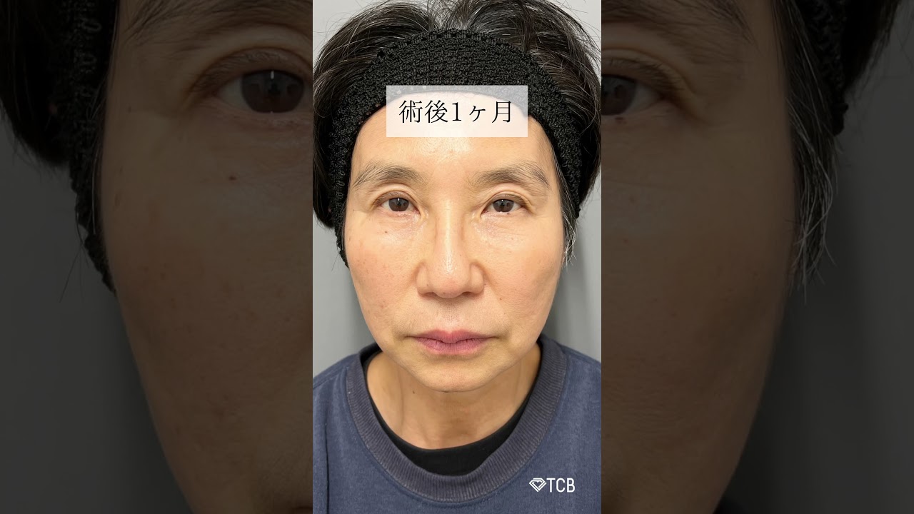 Youtubeのサムネイル