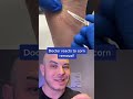 Doctor Reacts To Corn Removal On The Foot Corn Itscorn Dermreacts
