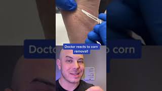 Download lagu Reaksi dokter setelah pengangkatan jagung di kaki! #jagung #itscorn #dermreacts mp3 Download lagu Reaksi dokter setelah pengangkatan jagung di kaki! #jagung #itscorn #dermreacts mp3