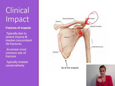 Clinical Anatomy for PA Students The Upper Extremity I