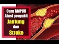 Cara AMPUH atasi penyakit JANTUNG dan STROKE Cara AMPUH atasi penyakit JANTUNG dan STROKE
