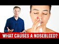 What Causes Nosebleeds Epistaxis 8 Common Causes Of Nose Bleeding Dr Berg
