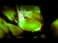 Anathema - Hope