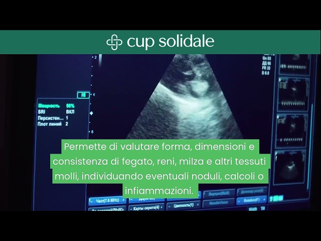 Video Ecografia Addome Completo https://www.youtube.com/watch?v=tK8QlCeIcu4