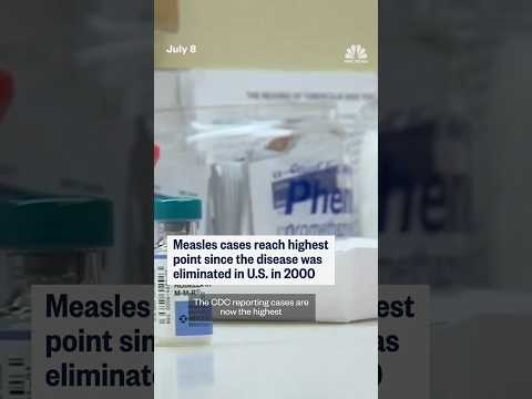 Measles cases hit highest point in U.S. since 2000