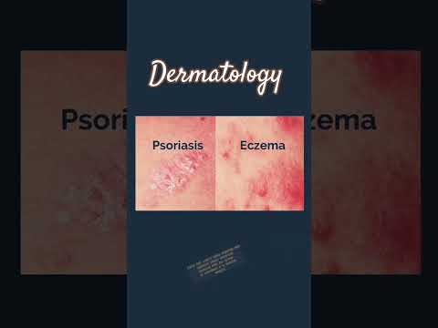 Diffeence between psoriasis and Eczema By Dr Firdose