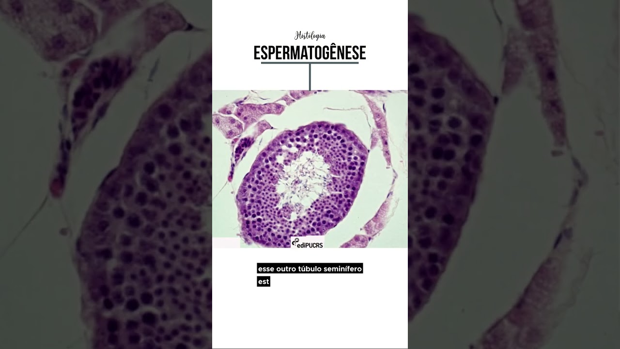 Túbulos seminíferos e Células Intersticiais - Espermatogênese - Histo (parte 2)