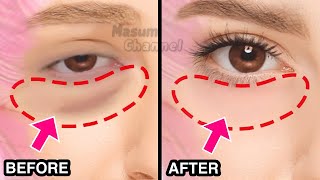 9mins Eye Bags Removal Exercise & Massage You Must Do | Droopy Eyelids, Dark Circles Under Eyes