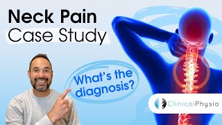 Neck Pain Case Study | What's the Diagnosis? Expert Physio Explains All the Clinical Reasoning!