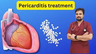 Pericarditis treatment