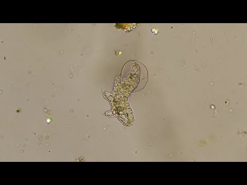 Tardigrade Hatching - A Rare Sight
