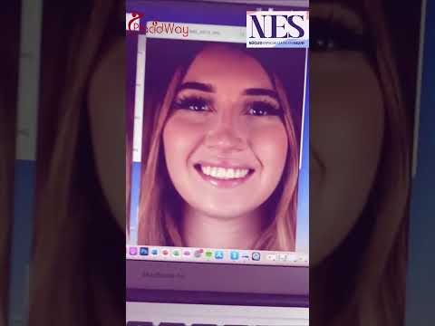 Build Your Smile with Smile Makeover in Juarez, Mexico by NES Clinic