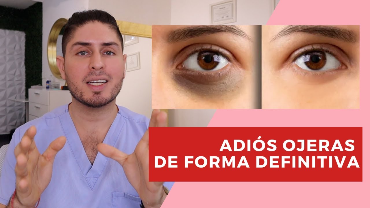 Watch Tratamiento para ojeras / TODO lo que tienes que saber 😱 - #DOCTORLEMUS Now Tratamiento para ojeras / TODO lo que tienes que saber 😱 - #DOCTORLEMUS