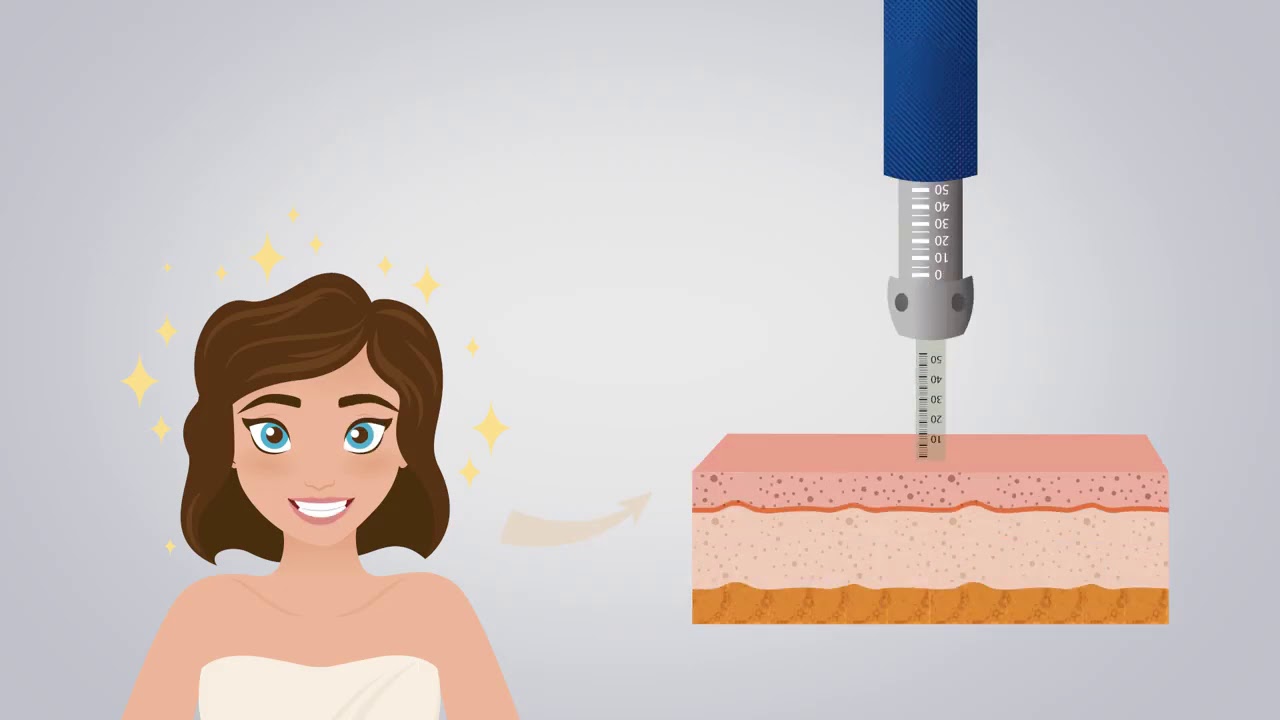 Intradermoterapia Pressurizada - Smart Press XS - Smart GR