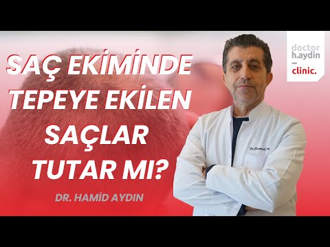 Saç Ekiminde Tepeye Ekilen Saçlar Tutar mı? - Dr. Hamid AYDIN