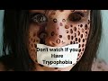 Unraveling Trypophobia: The Science Behind Fear of Small Holes