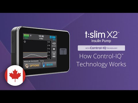How Control-IQ Technology Works on the t:slim X2 Insulin Pump