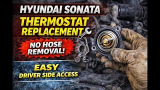 Hyundai Sonata Thermostat Replacement (2011–2019) | Overheating Fix