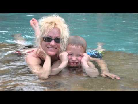 Facelift in Houston by Plastic Surgeon Michael Eisemann to correct signs of aging in the face.