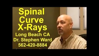 Spinal Curve X-rays | Long Beach | 562-420-8884 | Human Behavior