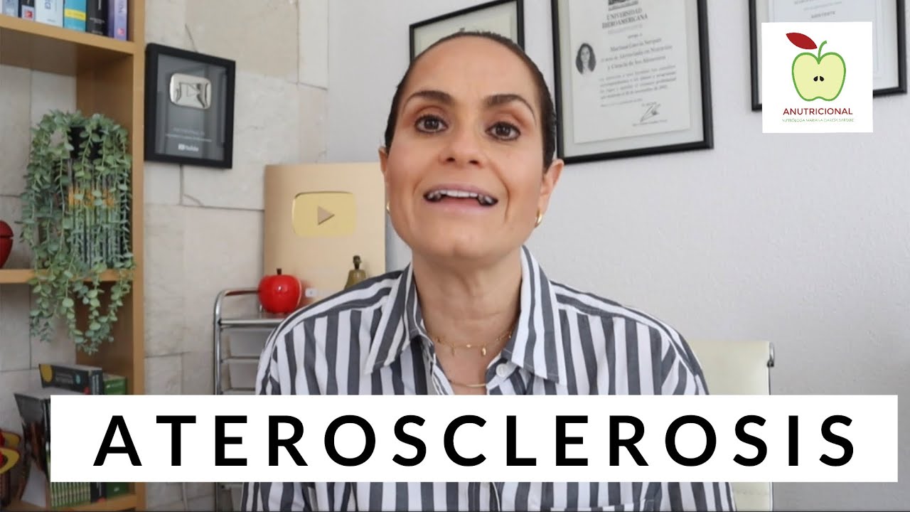 Todo Sobre La Aterosclerosis y La Alimentacion / Como Prevenirla y Controlarla