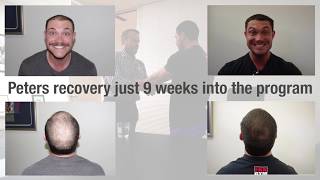 hair loss treatment post image
