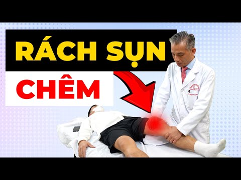 Rách Sụn Chêm - Dấu Hiệu Nguy Hiểm Không Thể Bỏ Qua