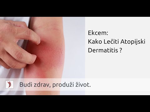 hipertenzija uzrokuje posljedice imam hipertenzija grade 2 rizik 3