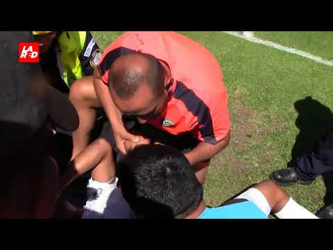 Video: Así fue la terrible lesión de Carlos Castrillo