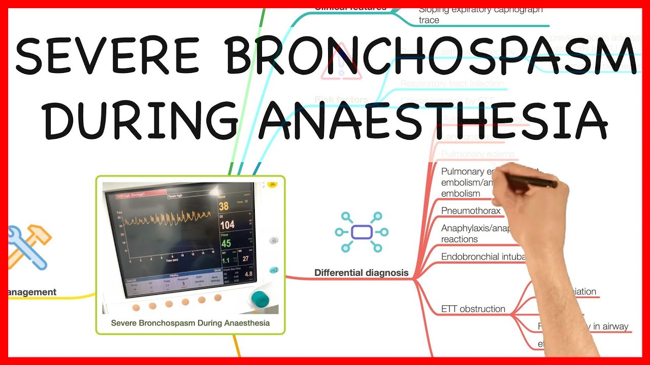 SEVERE BRONCHOSPASM DURING ANAESTHESIA -PRACTICAL CONDUCT SERIES - YouTube
