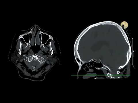 AI in Healthcare Systems