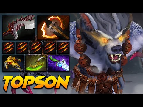 Topson Ursa Beast Mode - Dota 2 Pro Gameplay [Watch & Learn]