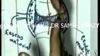 general pathology 20: TUBERCULOSIS 4 DR SAMEH GHAZY