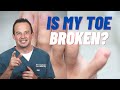 HOW CAN YOU TELL IF YOU BROKE YOUR PINKY TOE Dr Nick Campitelli