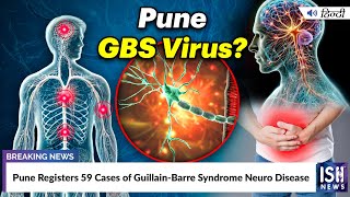 Pune Registers 59 Cases of Guillain-Barre Syndrome Neuro Disease