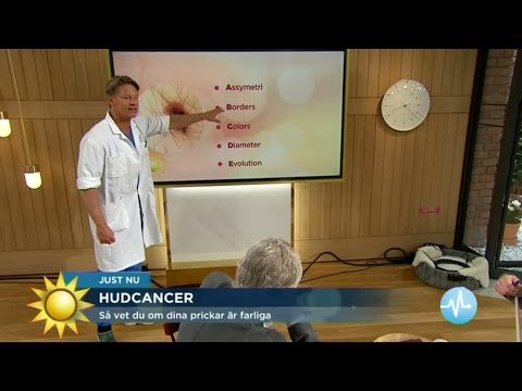 Så upptäcker du hudcancer - fem varningssignaler att hålla utkik efter - Nyhetsmorgon (TV4)