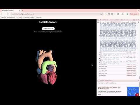 Project Cardiowave demo