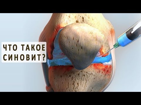 Чем отличаются боли в спине от болей в сердце Грыжа межпозвонкового диска в шейном отделе позвоночника