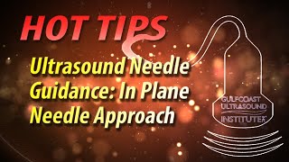 Ultrasound for Needle Guidance Using the In Plane Approach