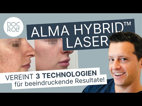 Neu: ALMA (CO2) HYBRID™ LASER - die Innovation der Hautverjüngung - Dr. Rolf & Katrin Bartsch
