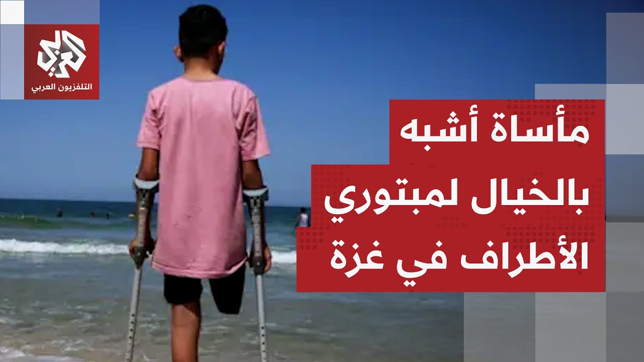 الحرب تخلف الآلاف من مبتوري الأطراف في غزة وإسرائيل تمنع سفرهم للعلاج بالخار