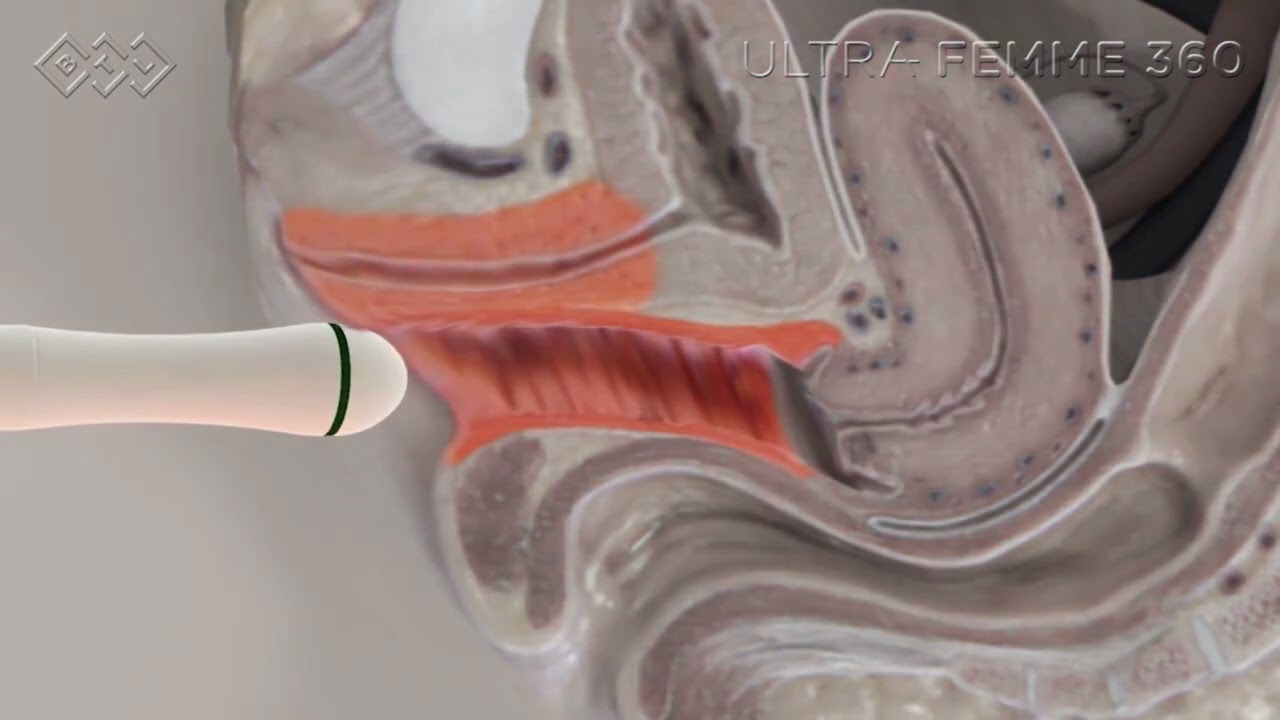 Encarnación Rizo Hurtado De Mendoza-8