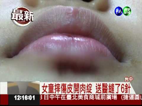 連鎖餐廳遊戲室 女童摔傷血直流