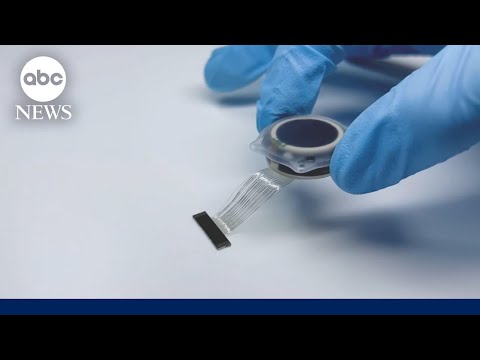 Elon Musk's Neuralink implants brain chip in first human