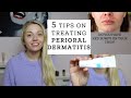 5 Tips on How I Treated my PERIORAL DERMATITIS