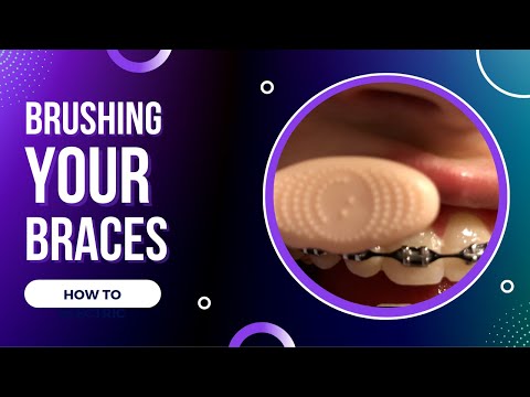 How to Brush with Braces Manual and  Electric
